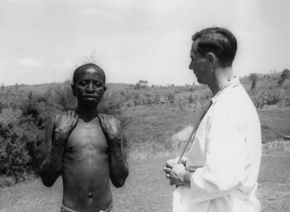 Heri Hospital where lepers are treated