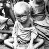 Malnurished African children